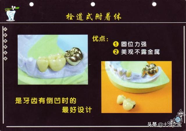 口腔精解图解