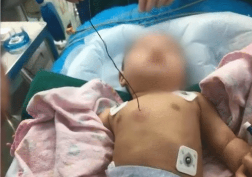 #婴儿#是亲妈所为,孩子父亲:她有病!4厘米钢针被刺进3个月婴儿心脏