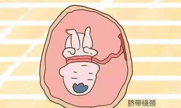aa4f4c53dbfd4fbeb8d791b42fadcd38.jpeg