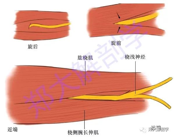 桡神经卡压查体及治疗定位