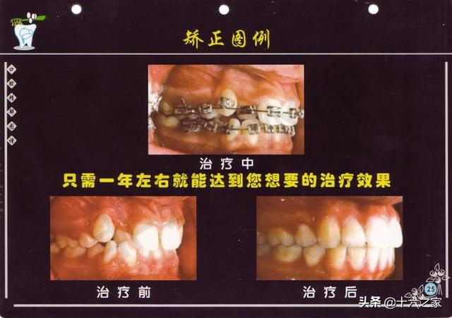 口腔精解图解