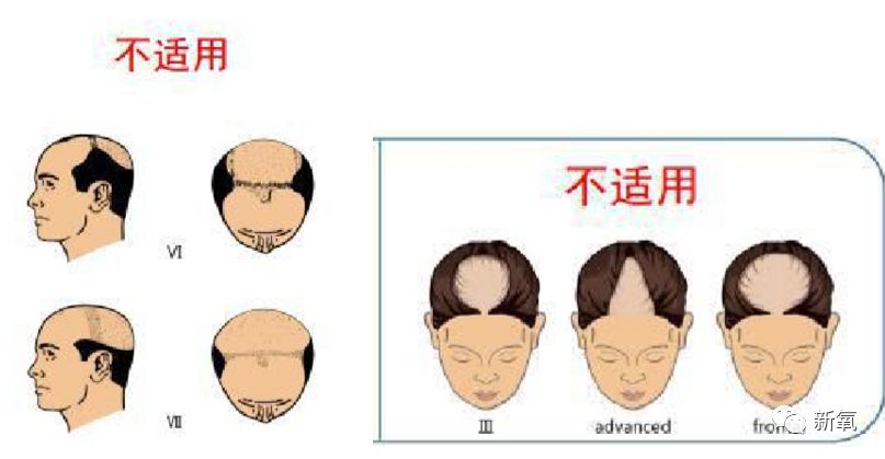 哔哔羊 e3f5770aed604034945adee444ea6ba7.jpeg