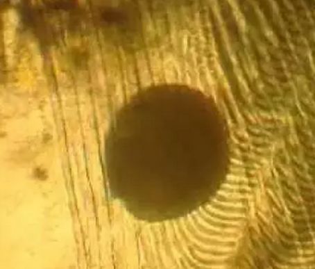 20种寄生虫图文病害收藏。(原虫类 蠕虫类 甲壳类)
