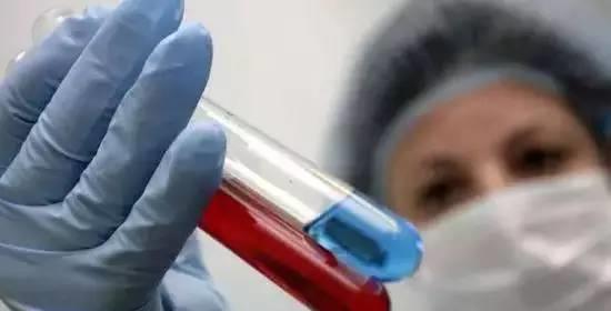 喝什么降尿酸血糖 08978b69409d45f4810cb47ea046fd4e.jpeg