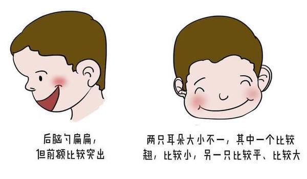 宝宝偏头,两边脸不对称,影响大脑零部件吗?这些问题更