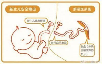 【存储】脐带血存储：商业骗局还是生命保险？