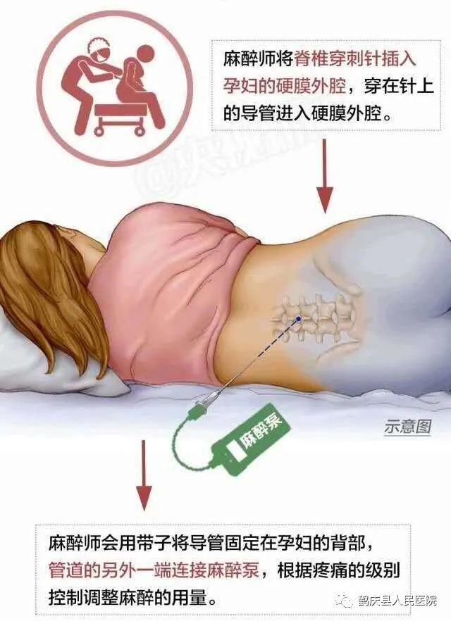 文章配图-1