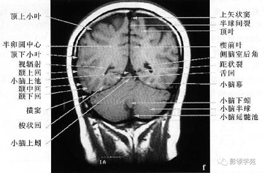基底节(basal ganglia)(又称基底神经节)是指从胚胎端脑神经节小丘