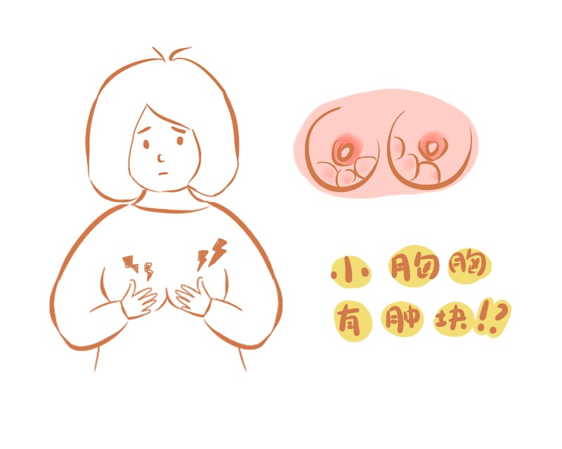 乳房有硬块，乳腺增生、乳腺炎该怎么办？这些事项请牢记！
