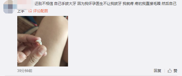 「智齿」吃嘛嘛都香生个孩子掉颗牙？孕妈妈经验分享：备孕先看牙