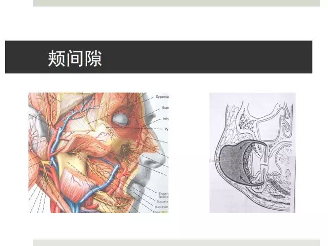 【牙医干货】口腔颌面部间隙感染(多图)!