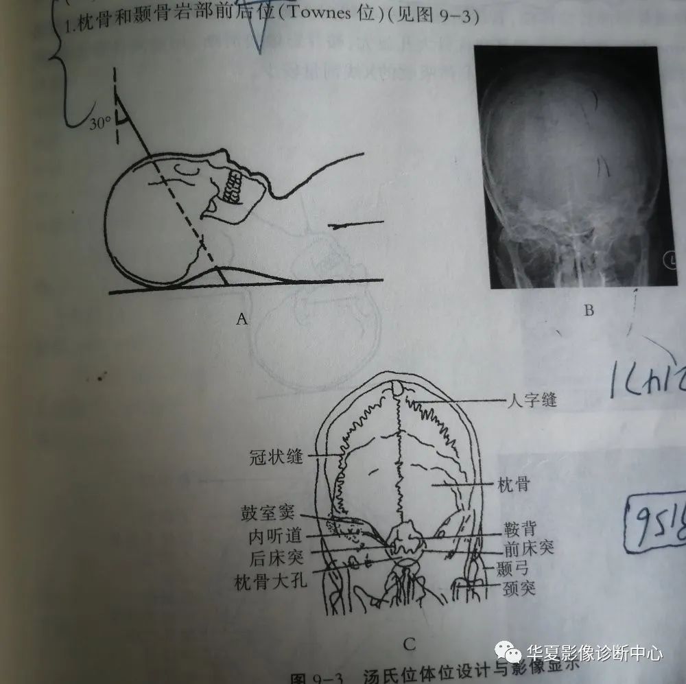 这是一篇80年代的影像技师才能看懂的检查单诊断师勿点头颅特殊部位