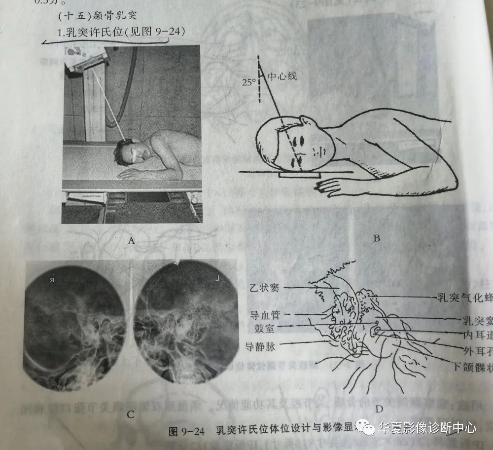 (头颅特殊部位)