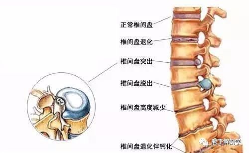 腰椎间盘突出趴着睡好 a7e9aa0e3a9e4ed3b925334a1e5b8350.jpeg