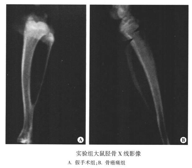 大鼠胫骨骨癌痛模型的建立及评价