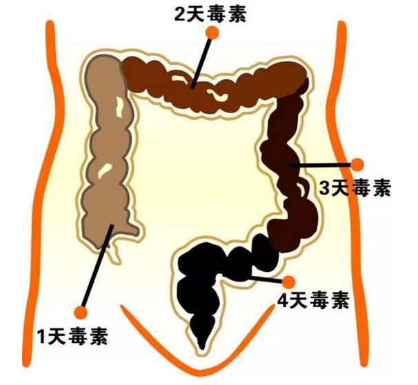 大便池堵了怎么办