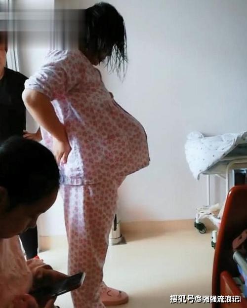 孕妈晒"悬浮肚"走红,人人说是双胞胎,孕妈遭遇让人心疼又担心