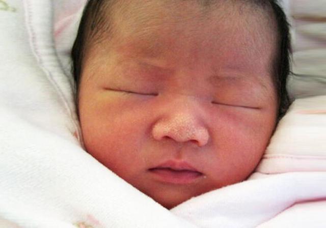 『家长』怎么处理更好？家长早知道宝宝不受罪新生儿常见的9种问题