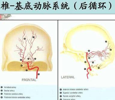 大脑后循环缺血的影像检查