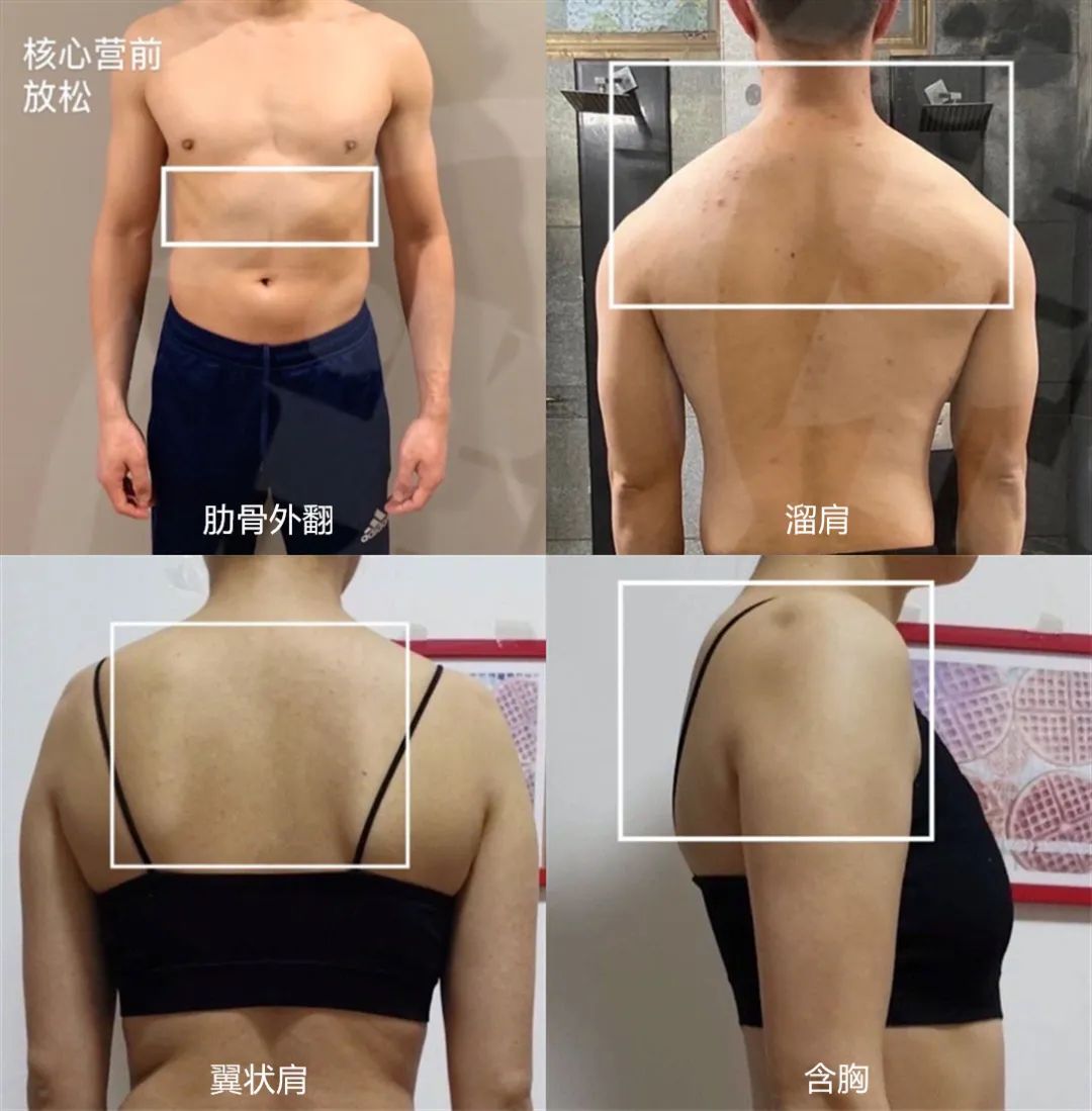 如何正常沉肩 5912a05ff20948a486384cde5adf2351.jpeg
