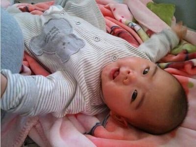 #小儿#家长要知道，3招教你消积食儿科医生：“小儿积食”的3个信号