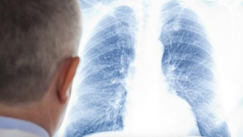 身体上有4个迹象表明您的肺部处于危险之中