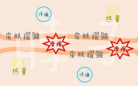 『爽身粉』孩子淹脖子怎么办？奶奶竟用爽身粉！这种错误别再犯了