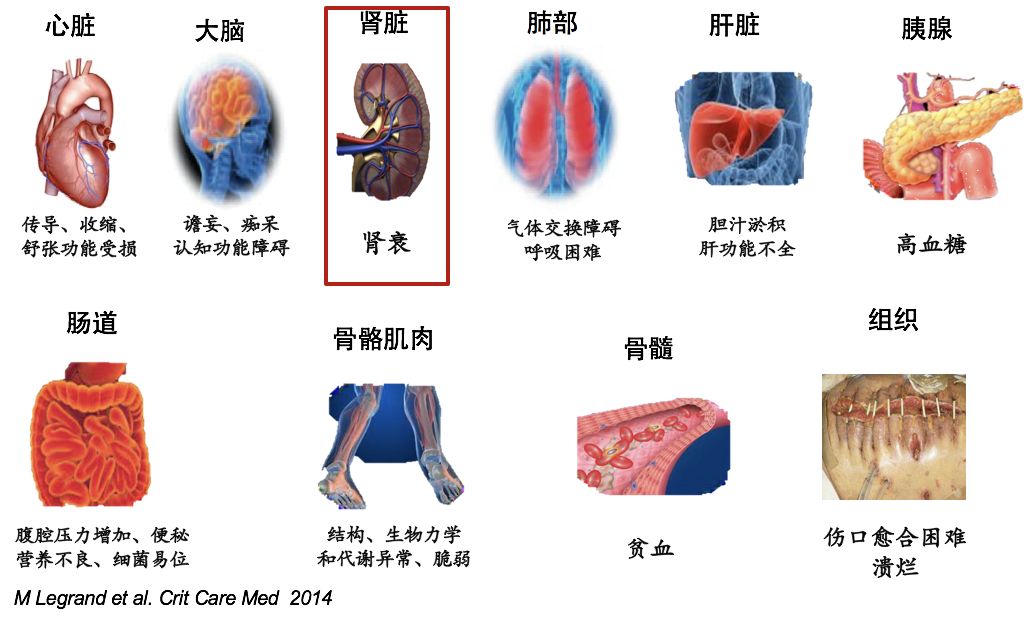 沈潞华教授:心源性水肿的诊断与鉴别诊断