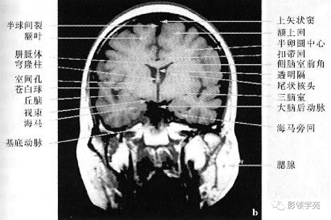 基底节(basal ganglia)(又称基底神经节)是指从胚胎端脑神经节小丘