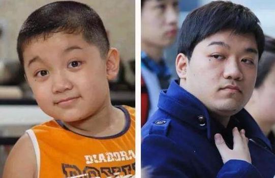 祸根：祸根在于三个坏习惯，你家娃或许已中招“毁容式长大”正流行
