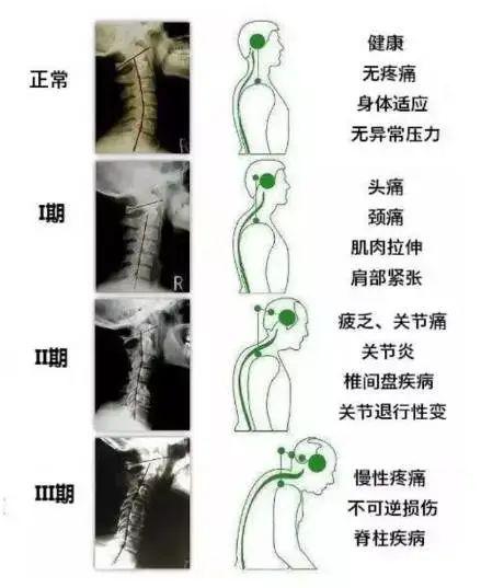 麻木是什么原理_麻木是什么意思(2)