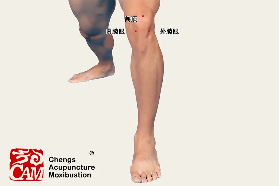 内膝眼和外膝眼也是经外奇穴，这两个穴位处在髌骨与小腿骨之间髌韧带两