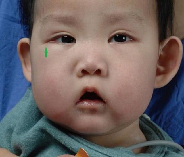 『孩子』妈妈却高兴不起来，医生：是种治不好的病男孩漂亮得像洋娃娃