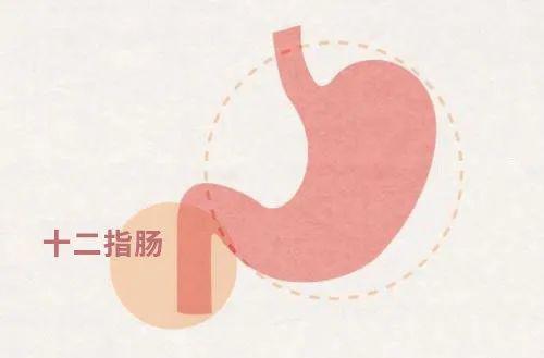 延安市人民医院普外科一病区成功实施胰十二指肠切除术