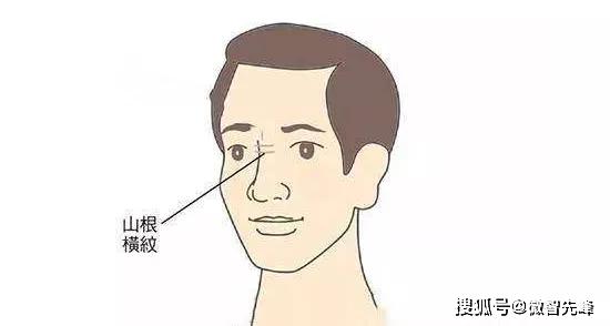 山根有横纹的人感情易失败