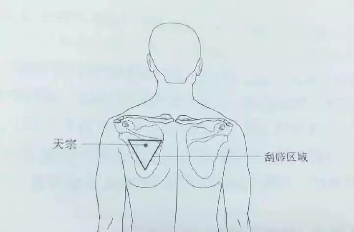 所以,天宗穴是个非常易堵的穴位,一定要着重处理.