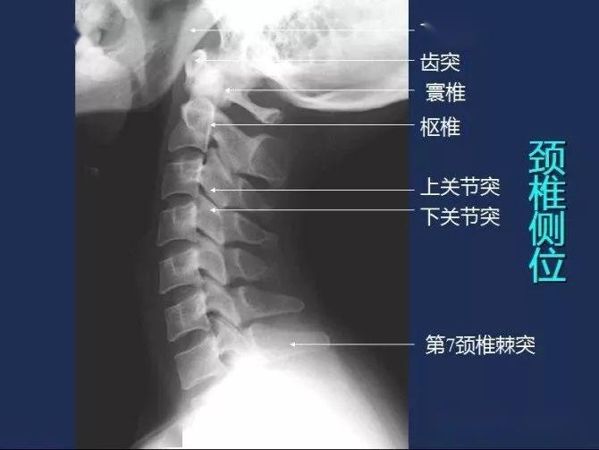 x线解剖图谱 系统解剖(骨骼篇),非常全面,强烈建议收藏