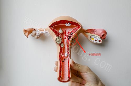 为什么会有子宫腺肌病 583cf0efddcb42ef82046b1a3420cf49.jpeg