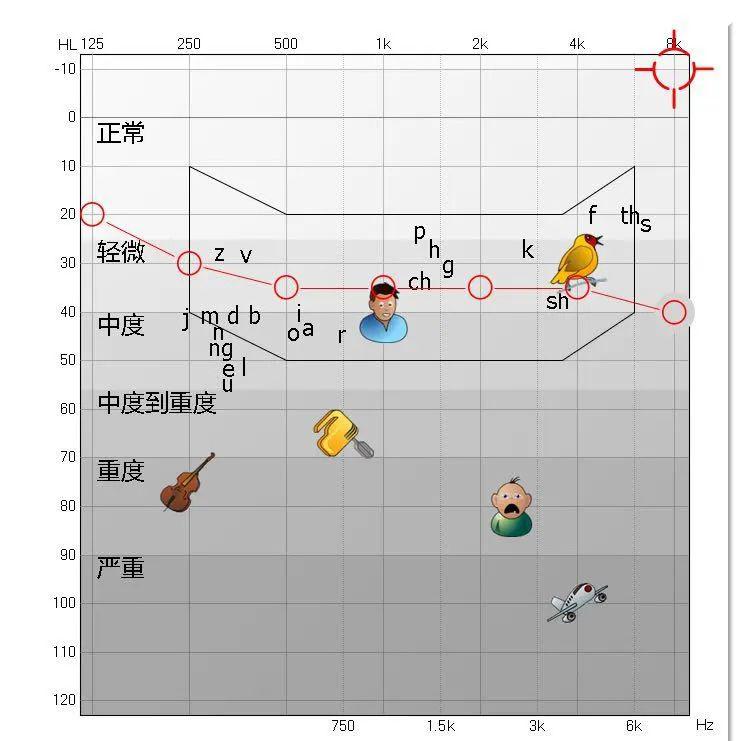 02中度听力损失law在中度听力损失曲线中的可听的区域与言语香蕉图