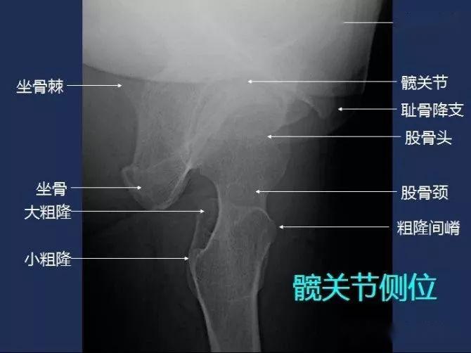 x线解剖图谱 系统解剖(骨骼篇),非常全面,强烈建议收藏