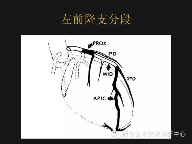 冠状动脉解剖精细到每一个分支