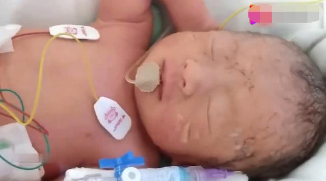 [宝宝]单看上身乖巧，可看到下半身网友无法淡定早产宝宝迷惑睡姿走红