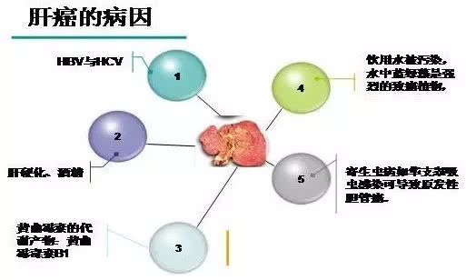 手把手教你如何预防和筛查肝癌