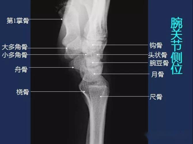 x线解剖图谱 系统解剖(骨骼篇),非常全面,强烈建议收藏