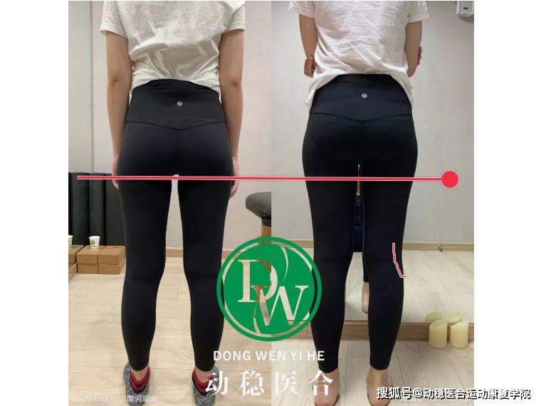 一个动作改善假髋(内附视频)_骨盆