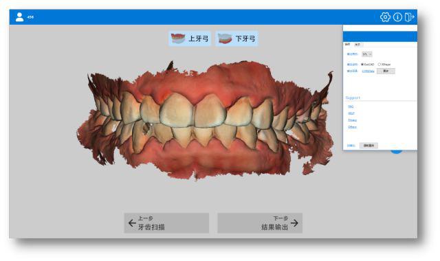 蓝野3d口扫带您体验全新取模方式