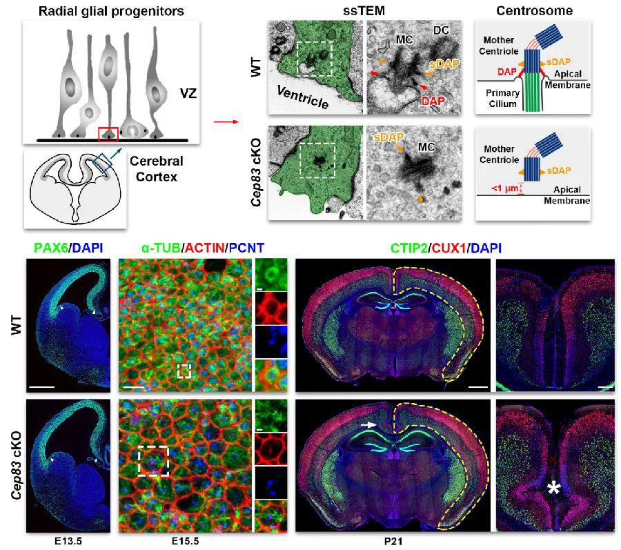 清华时松海和史航课题组在nature发文揭示中心体调控大脑皮层发育的