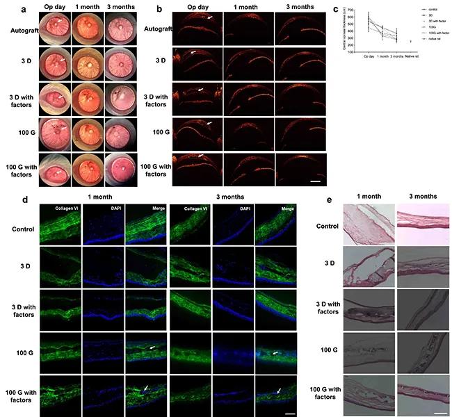 (c)术后不同时间段中央角膜的厚度(d)术后1个月和3个月免疫荧光染色