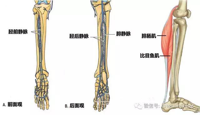 肌间静脉血栓到底是否需要抗凝?