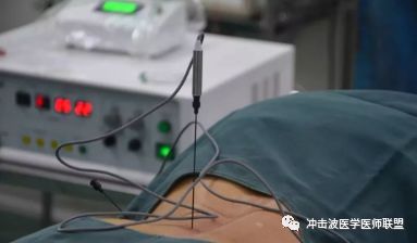 射频微创消融治疗技术创伤小！无疼痛！恢复快！